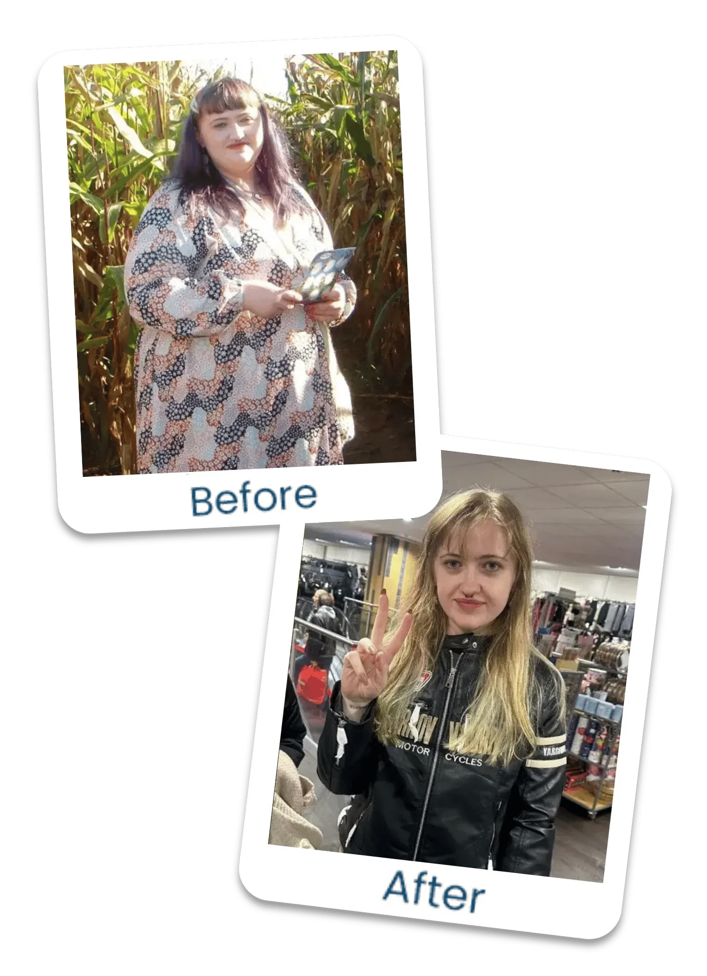 Dr Bazire - Imogen before and after shadow