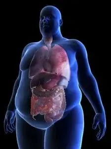 Body-Fat-Distribution-225x300