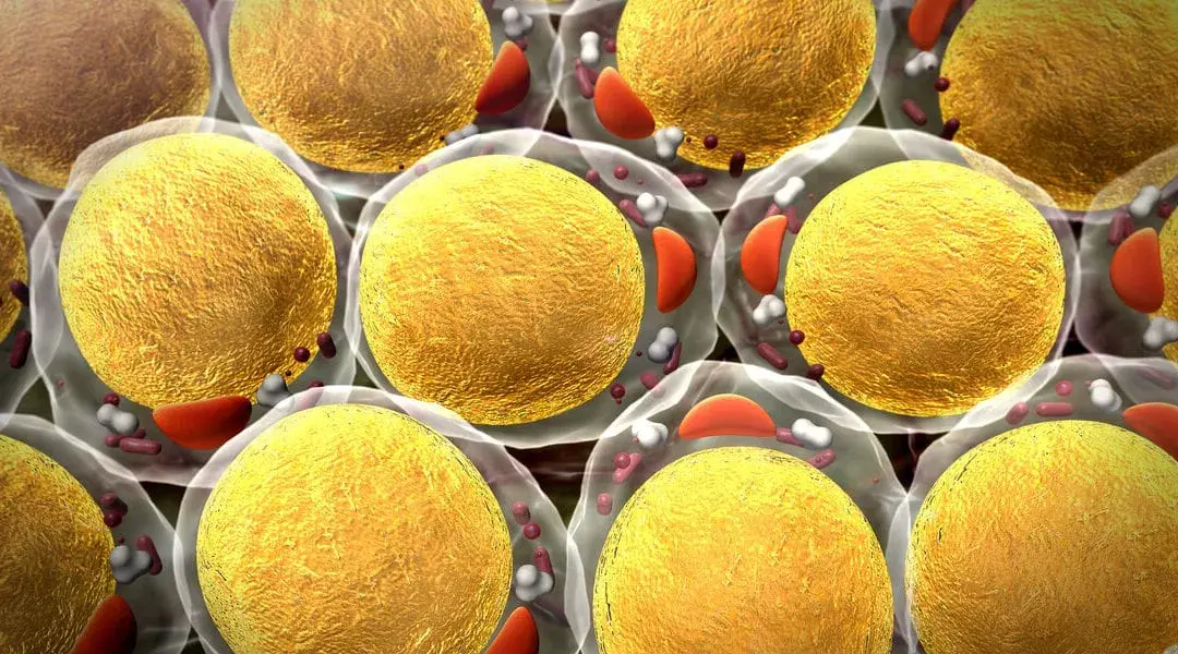 what-is-lipoinflammation